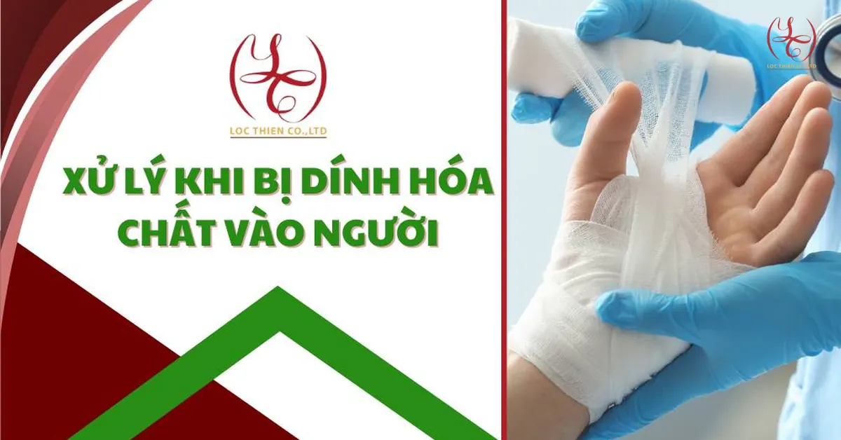 Xử Lý Khi Bị Dính Hóa Chất Vào Người Trong Phòng Thí Nghiệm